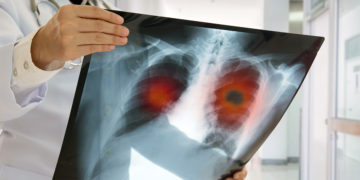 Vaping and disinformation: when scientific information meets politics